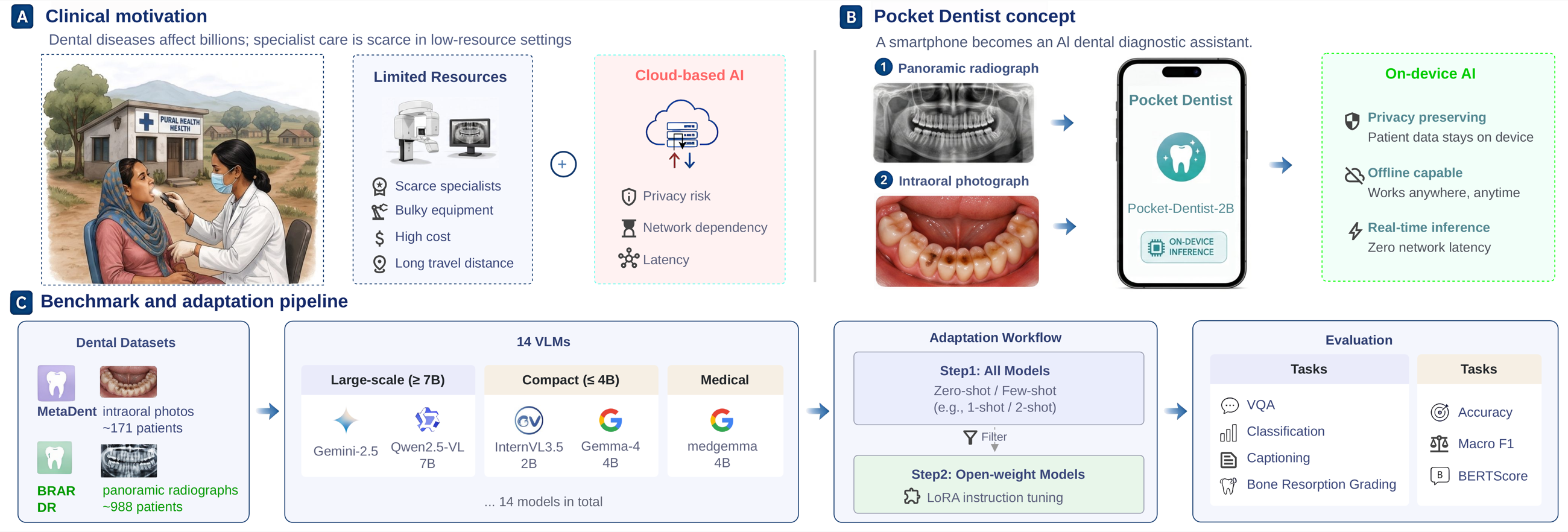 Pocket-Dentist pipeline overview